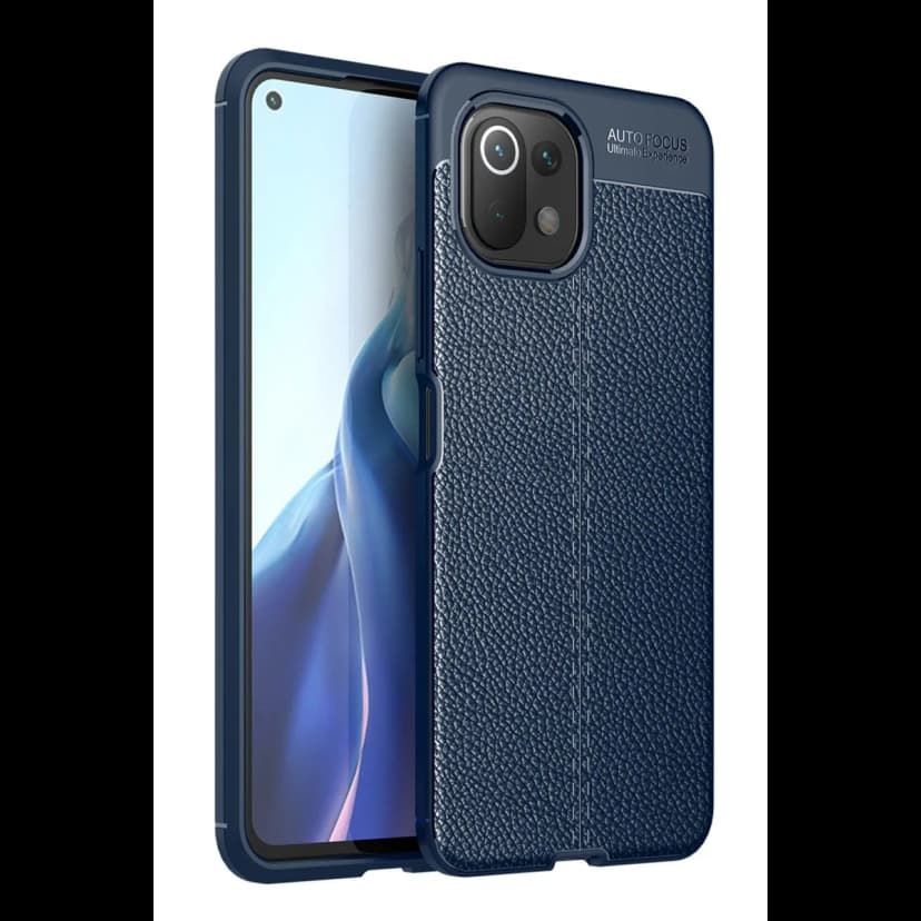 Newface Xiaomi Mİ 11 Lite Kılıf Auto Focus Kapak
