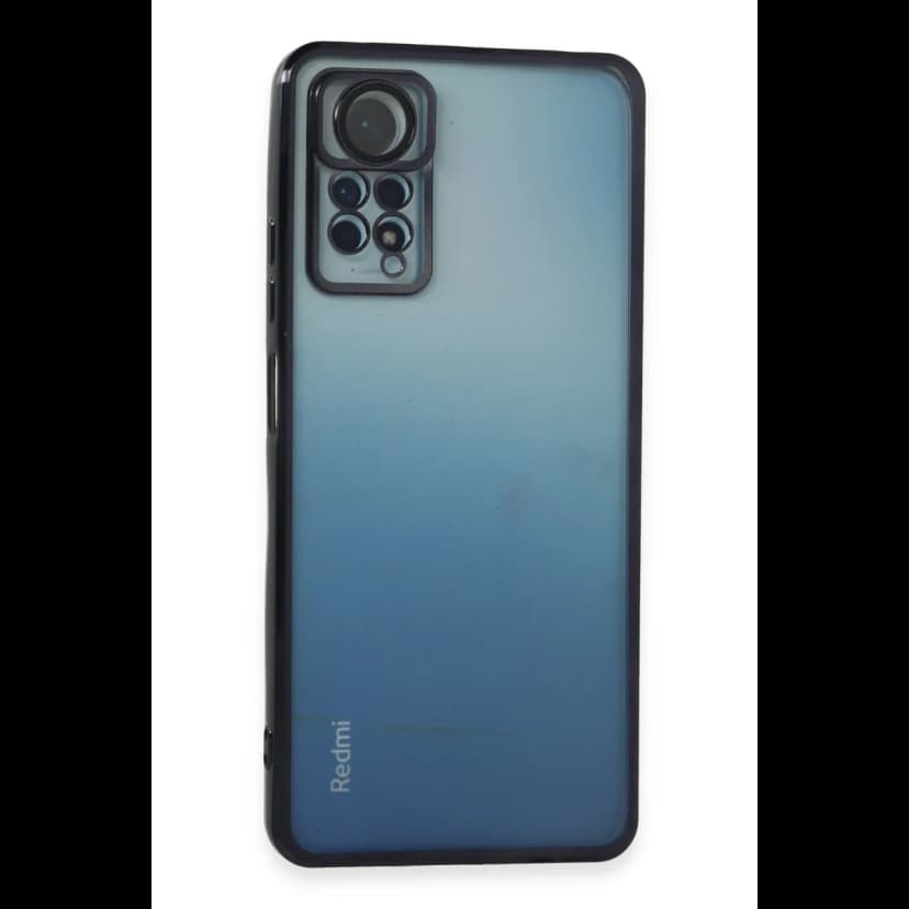 Newface Xiaomi Redmi Note 11 Pro Kılıf Razer Lensli Silikon