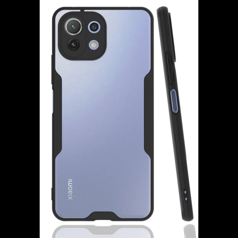 Newface Xiaomi Mİ 11 Lite Kılıf Platin Silikon - Siyah