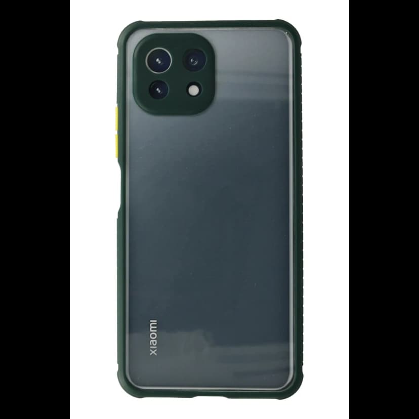 Newface Xiaomi Mİ 11 Lite Kılıf Miami Şeffaf Silikon - Koyu Yeşil